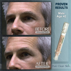 EUZEN Skin Tightening Cream texture on hand ready for use.