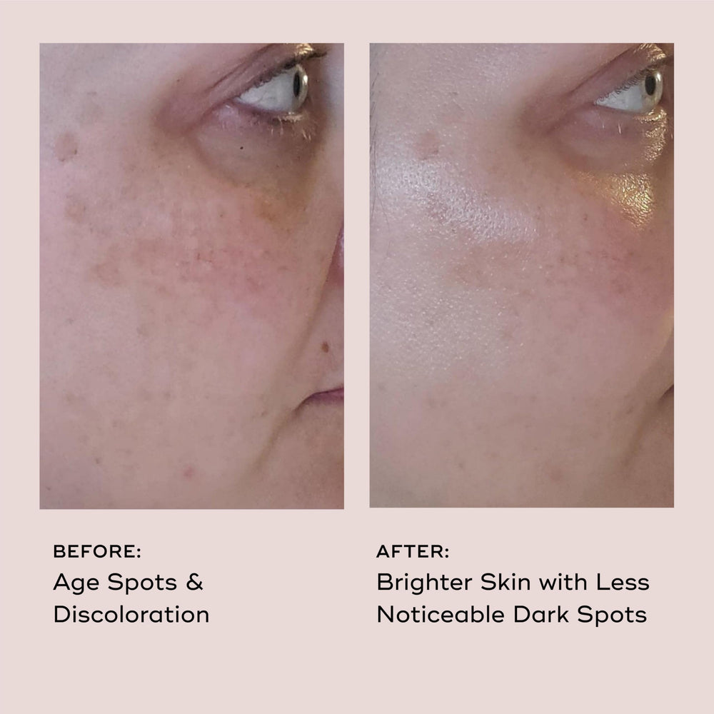 Close-up of EVER Vitamin C serum texture absorbed on skin.