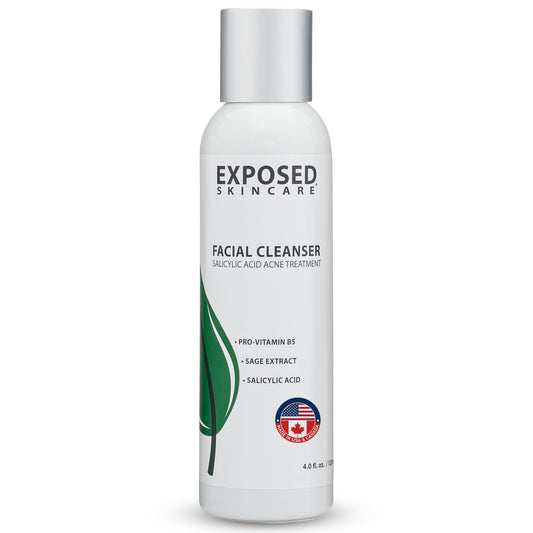 Exposed Skin Care acne cleanser bottle close-up for sensitive skin and clear pores