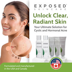 Exposed Skin Care moisturizer bottle locks in hydration without clogging pores