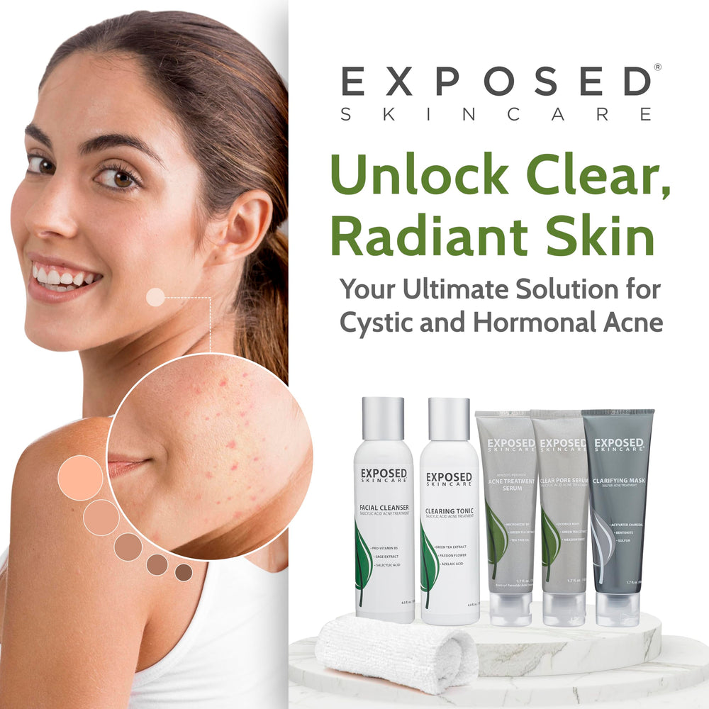 Exposed Skin Care ingredient bottles showcase key actives.