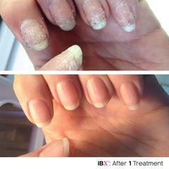 Famous Names Free Dadi Oil demonstrates hydrating finish for nails