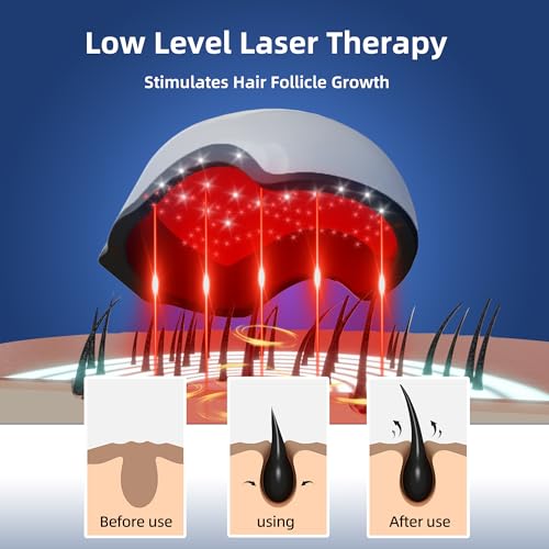 Hair Growth Device battery life up to 180 minutes for sessions