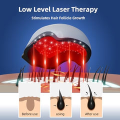 Hair Growth Device battery life up to 180 minutes for sessions