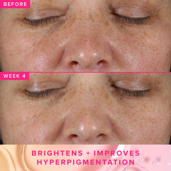 Farmacy 5PHA exfoliating toner swirl suggests gentle resurfacing for radiance
