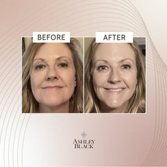 Ingredients spotlight highlights botanicals designed for long-term tightening.