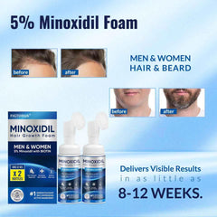 FIGTORUS hair and beard application demonstrates dual-use for fuller appearance.
