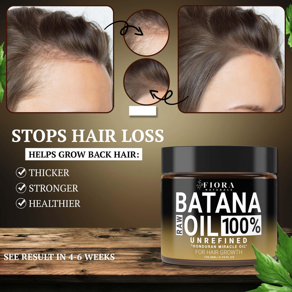 Applying Fiora Naturals Batana Oil Paste to scalp for nourishment.