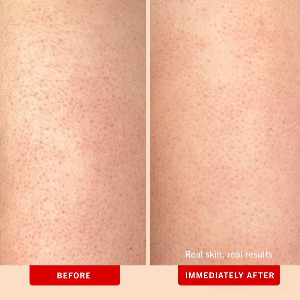 First Aid Beauty KP Bump Eraser with glycolic and lactic acids loosens rough patches