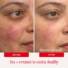 First Aid Beauty Ultra Repair Cream label highlights 0.5% colloidal oatmeal benefits