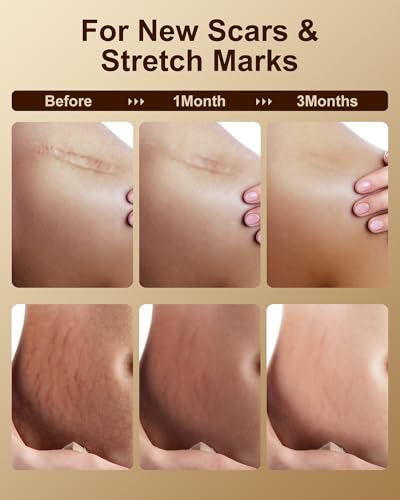 FLOWHYET vitamin E oil scar-care focus image for smoother-looking skin.