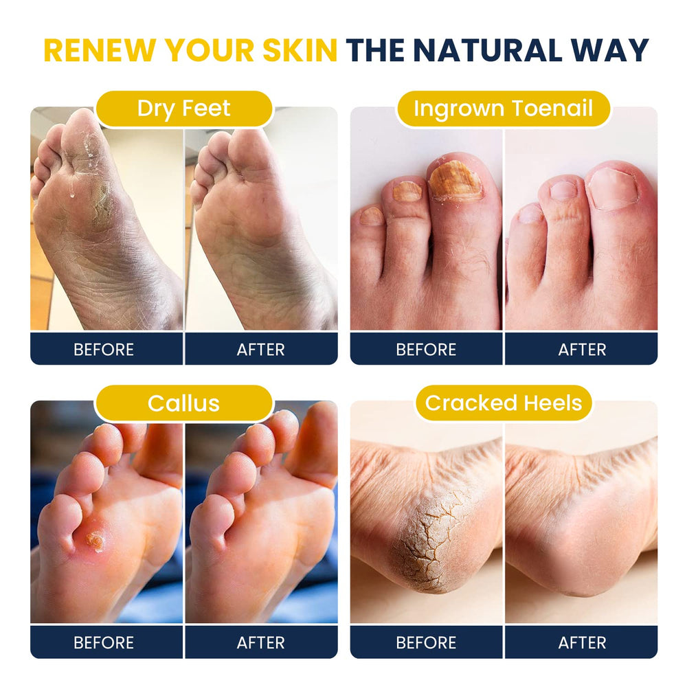 Foot Cure Citrus Detox two-pack ready for home spa use