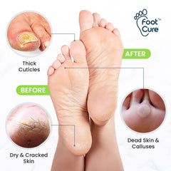Foot Cure Epsom Salts bath blend nourishes and relaxes feet.