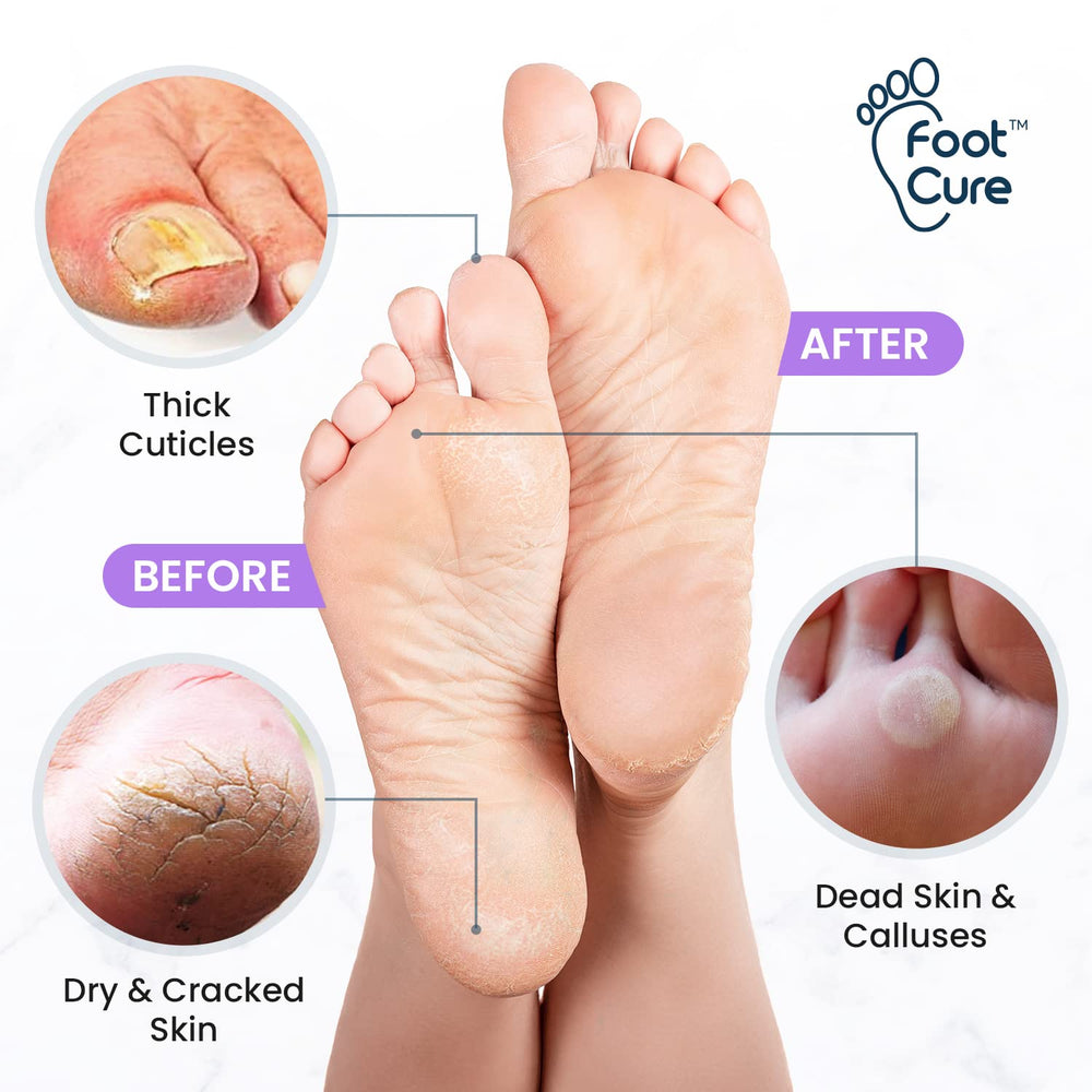 FOOT CURE Epsom Salts Soak image emphasizing mineral-rich soak for relaxation.