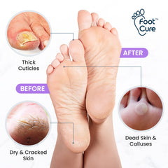 FOOT CURE Epsom Salts Soak image emphasizing mineral-rich soak for relaxation.