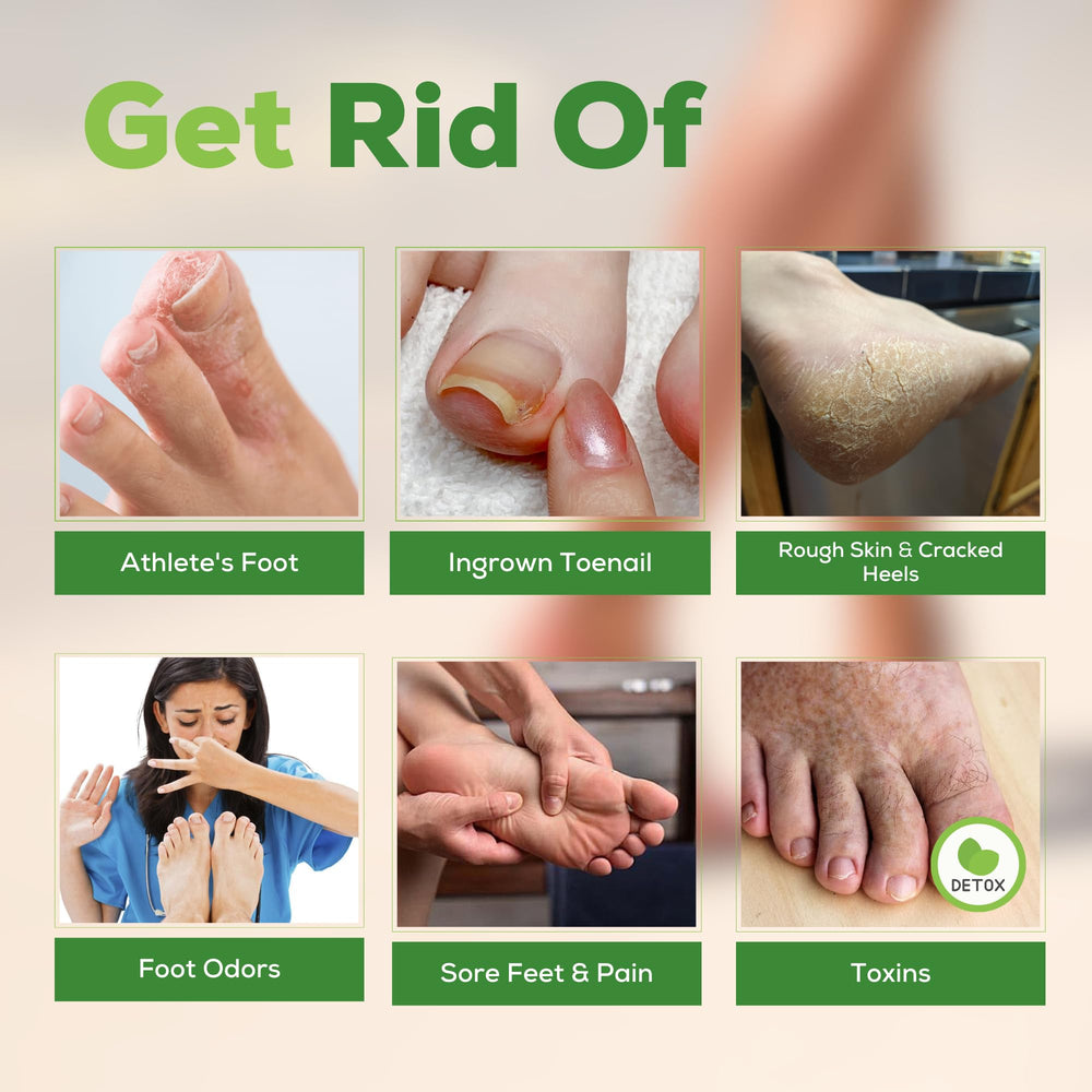 FOOT CURE softens calluses with a gentle foot soak