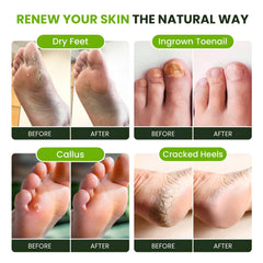 Foot Cure Tea Tree Oil Foot Soak close-up of essential oils and minerals