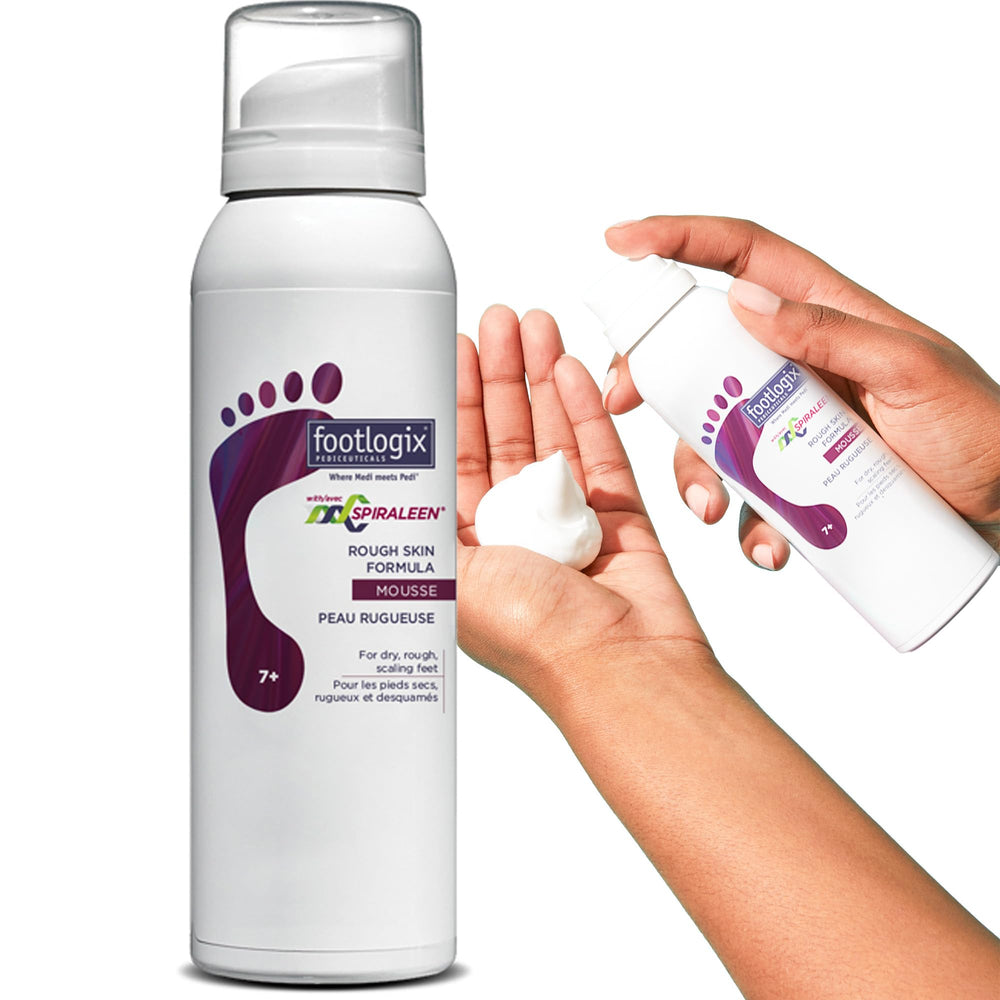 Footlogix rough skin formula Spiraleen mousse bottle shown for easy application.