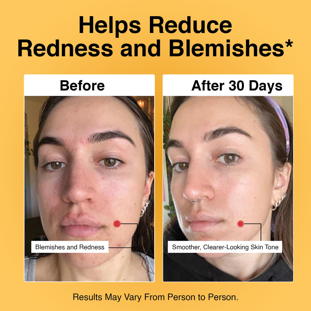 Foundation Skincare azelaic acid 14 percent even-tone close-up supports clearer, balanced skin