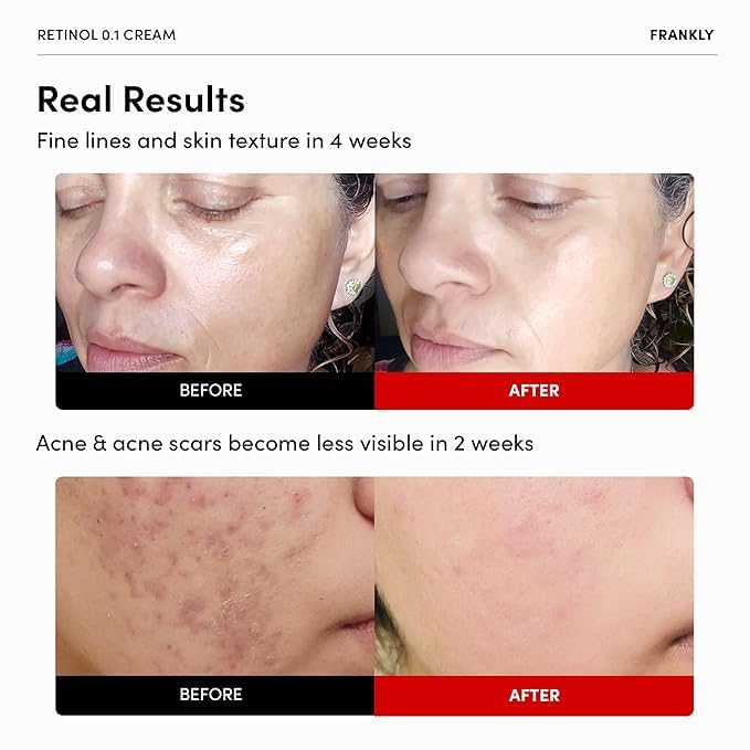 FRANKLY Retinol cream with ceramides and ginseng for hydration.