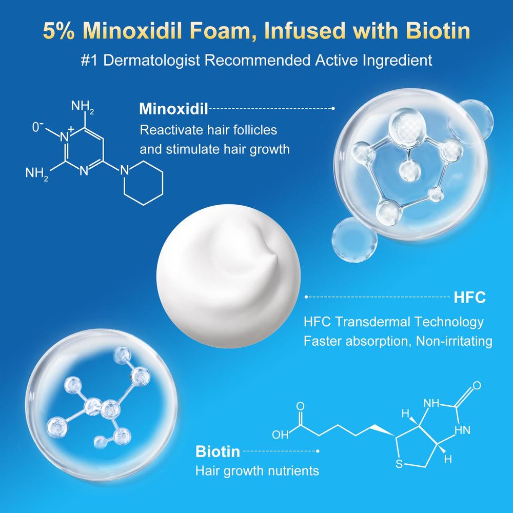 Frnoip Minoxidil Foam applied to thinning scalp areas for fuller appearance.
