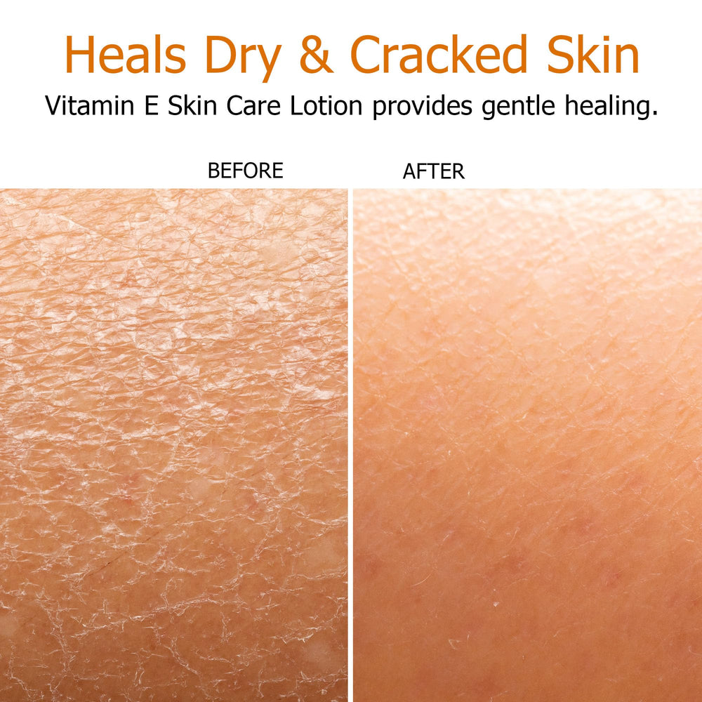 Ingredients closeup of Fruit of the Earth lotion with aloe vera and nourishing oils