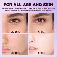 FullMeet Calcium Intense Cream applied on neck and face areas.