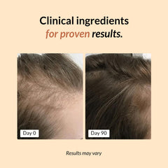 FullyVital ingredients label highlights biotin, saw palmetto, and ashwagandha for hair support.