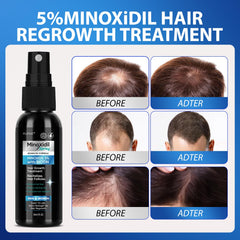 Close-up of the FUZYAT minoxidil solution highlights easy-to-use spray.