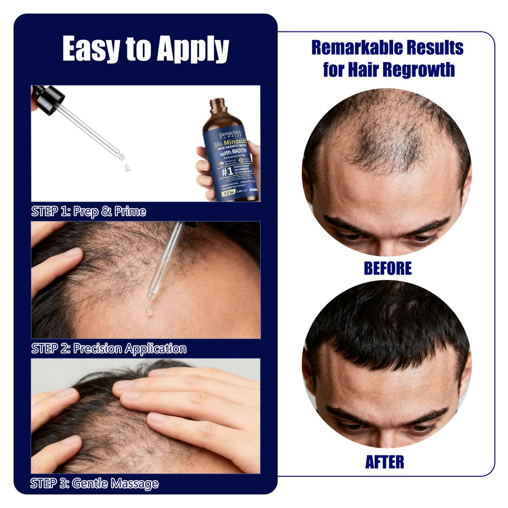 Gemächl ich Zu Hause scalp application supports clean absorption.