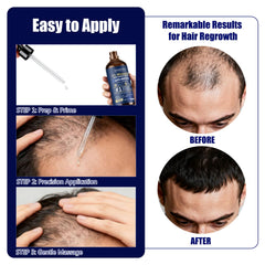 Gemächl ich Zu Hause scalp application supports clean absorption.