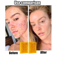 Generic lemon turmeric kojic soap with foaming net delivers dense, rich lather.