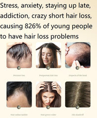 Ginaday ginger plant extract shampoo root care image suggests scalp nourishment