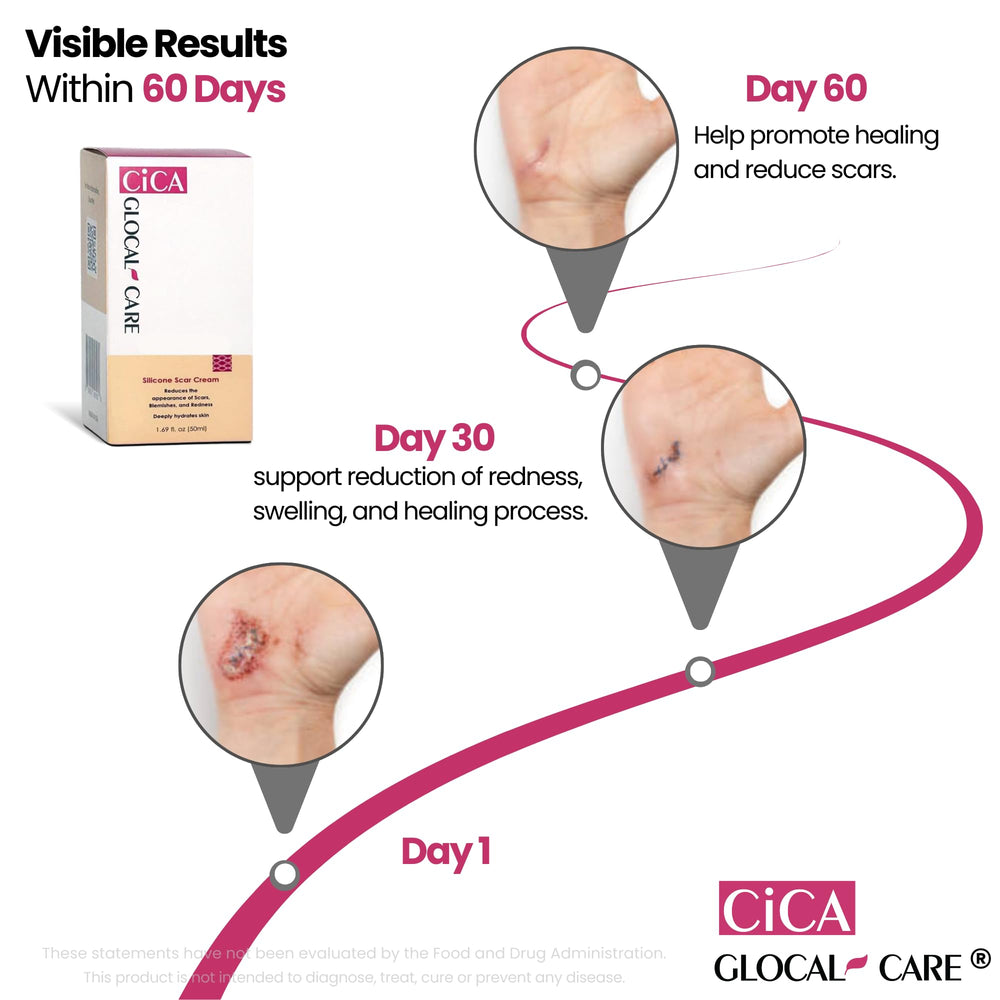 Panthenol and Niacinamide in GlocalCare CICA scar cream offer soothing care.
