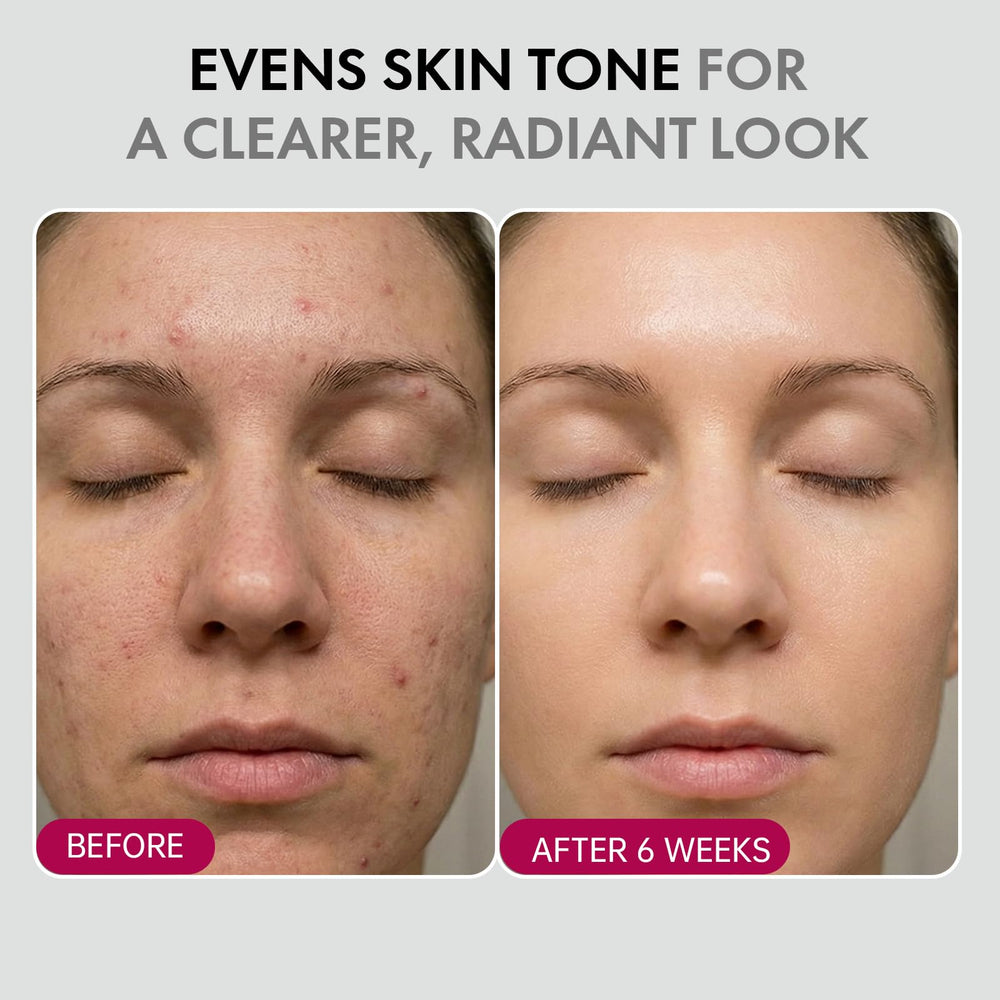 Glopink formula swatch hints at improved dark spots and clarity