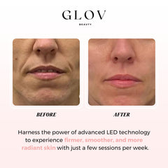 Glov Beauty LED mask user reading during therapy