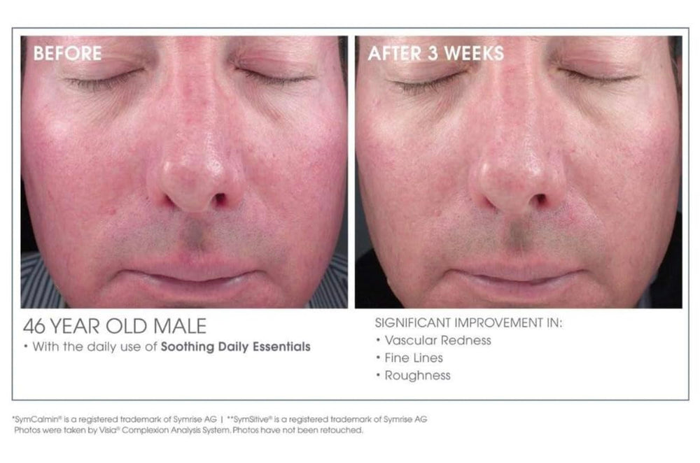 Glowbiotics Calming Restorative Treatment after-application glow indicating calmer complexion