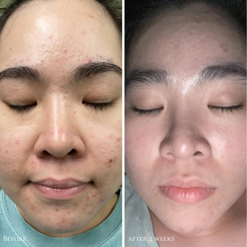 Glowbiotics Clarifying Pads skin-tone illustration suggesting radiant brightness.