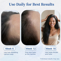 Gluvelessia stainless steel roll-on for mess-free thinning areas