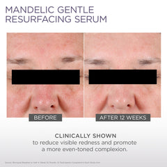 Glytone clinical results badge indicating dermatologist-recommended quality.