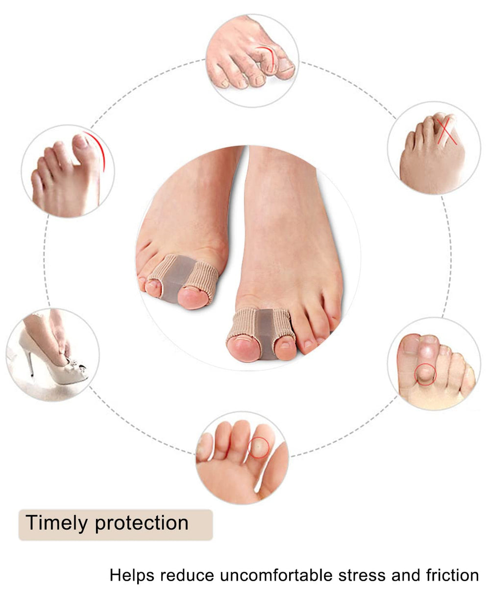 Golbylicc 4-pack unboxing; complete toe separation solution