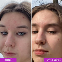 Good Molecules Niacinamide Serum box packaging highlights clean formula.