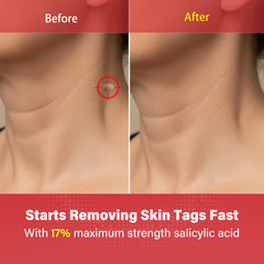 Goodnites Skin Tag Remover dotting action demonstrates precise application on a tag.