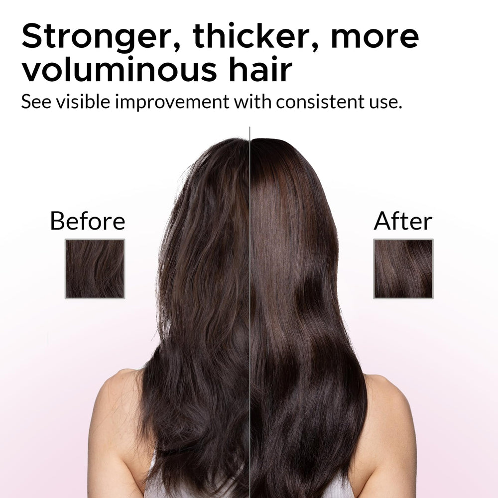 Growth Essence Minoxidil Shampoo bottle cap close-up hints at easy daily dosing.