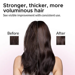 Growth Essence Minoxidil Shampoo bottle cap close-up hints at easy daily dosing.