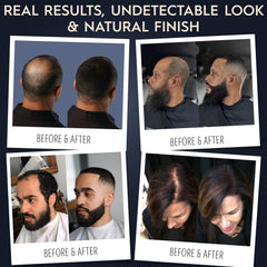 Hair Illusion thinning-areas coverage for a discreet improvement