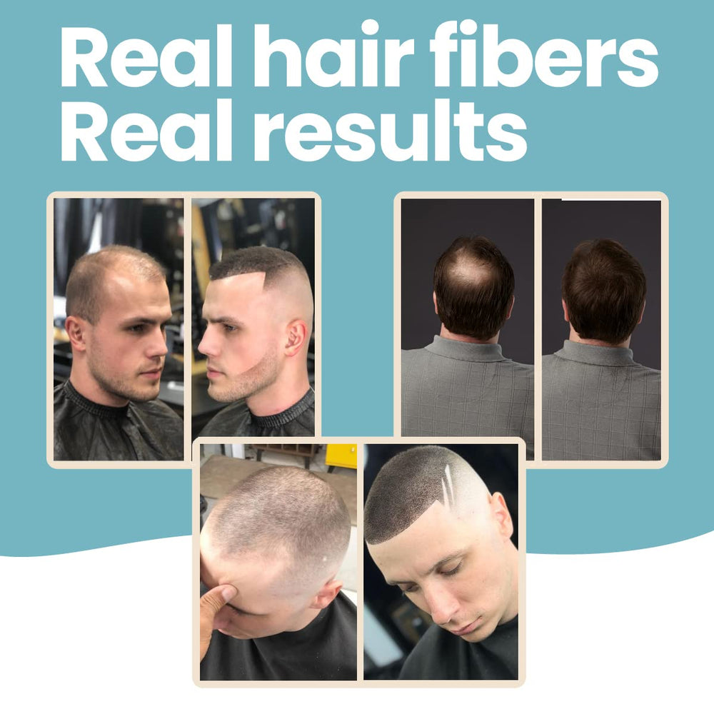 Hair Illusion scalp coverage close-up demonstrates seamless blend with natural hair