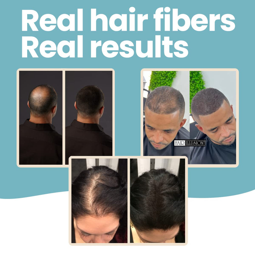Hair Illusion thinning crown coverage in a real-life scenario.