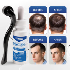 Hair Regen bottle label close-up showing dosage and branding.