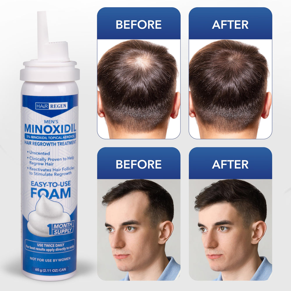 Hair Regen Minoxidil Foam smooth texture for comfortable daily use